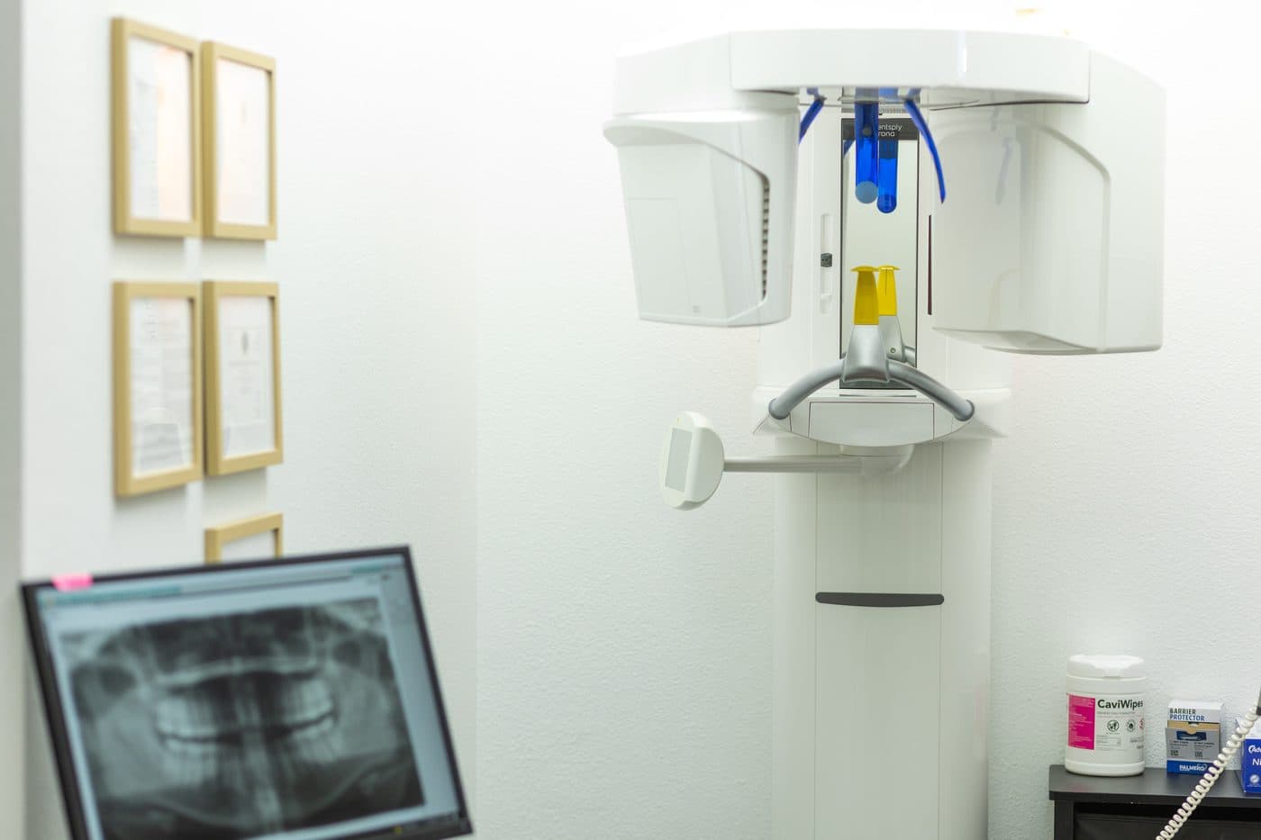 El tomógrafo 3D de haz cónico en la oficina de Soleil Dental Mesquite, con una radiografía panorámica en el monitor de al lado