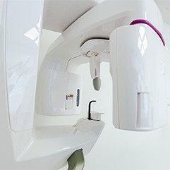 Close up of cone beam scanner