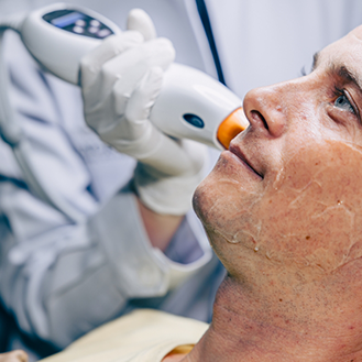 Senior man having an Opus skin resurfacing laser applied to his cheek