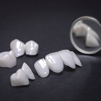 Several dental veneers laying on a flat surface