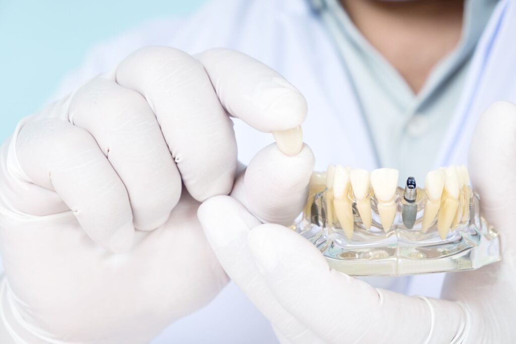 Dentist in white coat and gloves holding sample dental implant