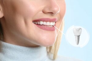 Woman smiling with dental implant inlay. 